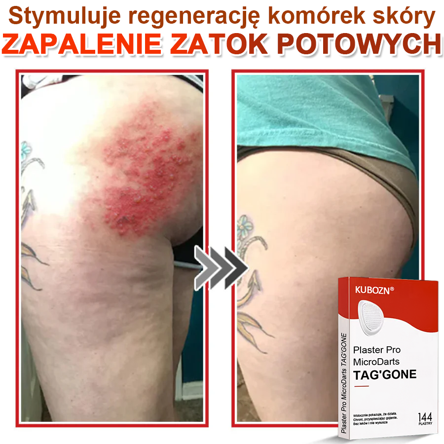 🌈 KUBOZN® mikrotűs botanikai tapasz a bőr szemölcseinek eltávolítására