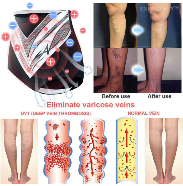 Orvosi minőségű titánszálas önmelegedő turmalin formájú rövidnadrág