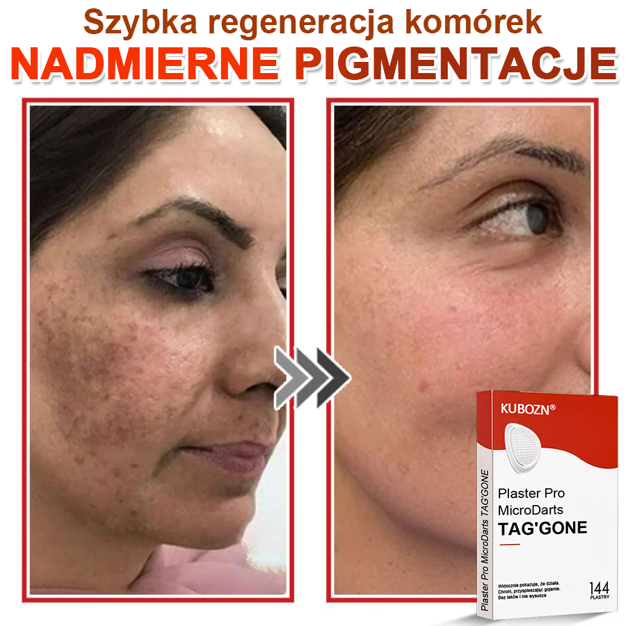 🌈 KUBOZN® mikrotűs botanikai tapasz a bőr szemölcseinek eltávolítására