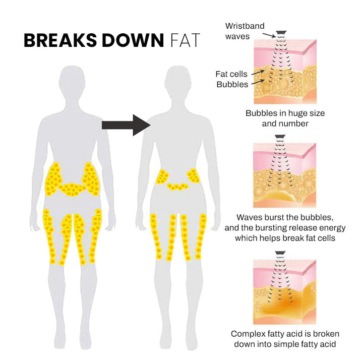 (🔥UTOLSÓ NAP 70% KEDVEZMÉNY) Histone Matteo Ultrasonic Body Shape Wristband Pro 🔥