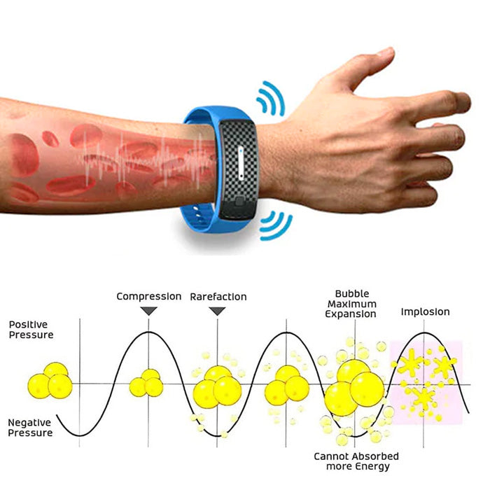 (🔥UTOLSÓ NAP 70% KEDVEZMÉNY) Histone Matteo Ultrasonic Body Shape Wristband Pro 🔥