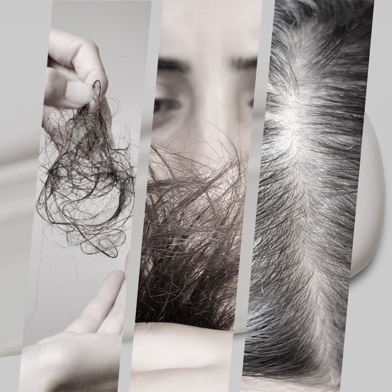 ✨ Napi 49% kedvezménnyel ✨ 2 az 1-ben természetes ezüst kivonatú hajfestés