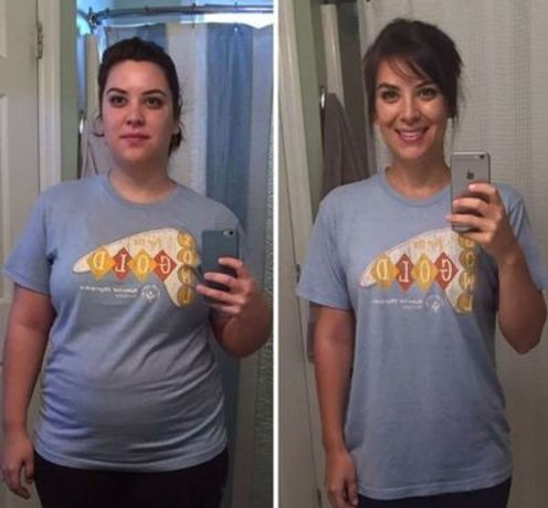 INGYENES SZÁLLÍTÁS AFIZ TURMALIN LYMPH KARCSÚSÍTÓ ORVOSI ZOKNI