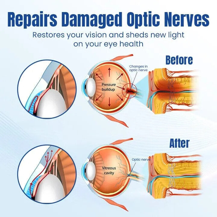 CEOERTYTM OPTIRENEW SZEMÁPOLÓ CSEPPEK