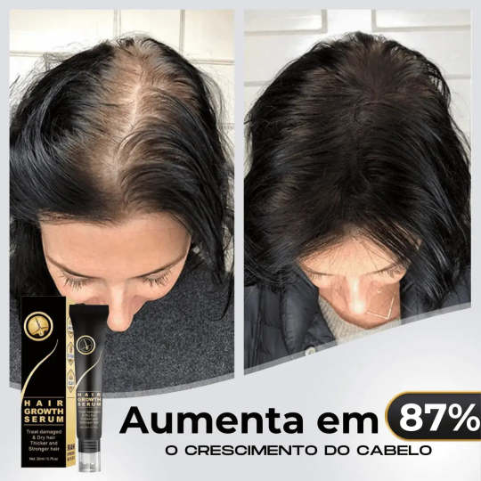 95%-os csökkenés csökkenés, 20x növekedés növekedés | Fix Your Hair®