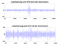 Lyseemin™ Anti-Tracking AI-Chips Signalstörung Smartwatch