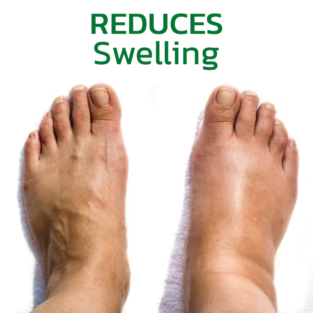 GFOUK™ GingerLegs Anti Swelling Méregtelenítő Kenőcs