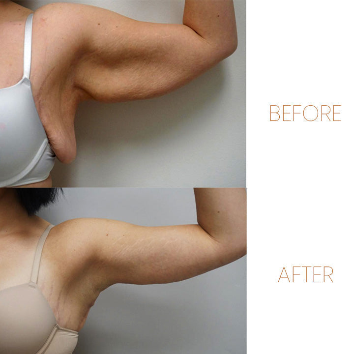 Háromgyűrűs JANSIO Treanic mágneses spinterápia