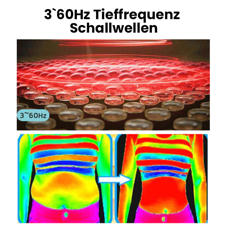 Oveallgo™ MatteoMiracle ultrahangos testformáló karkötő