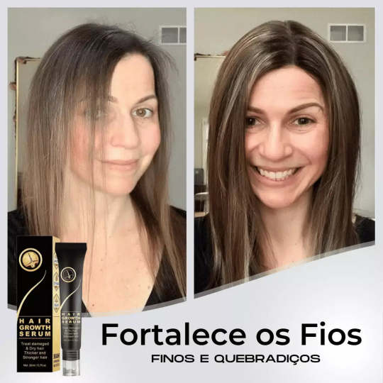 95%-os csökkenés csökkenés, 20x növekedés növekedés | Fix Your Hair®