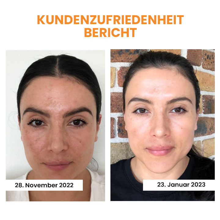 OVEALLGO™ KOREANISCHE ULTIMATIV DERMALAYER-TECHNOLOGY LÖSLICHER KOLLAGENFILM