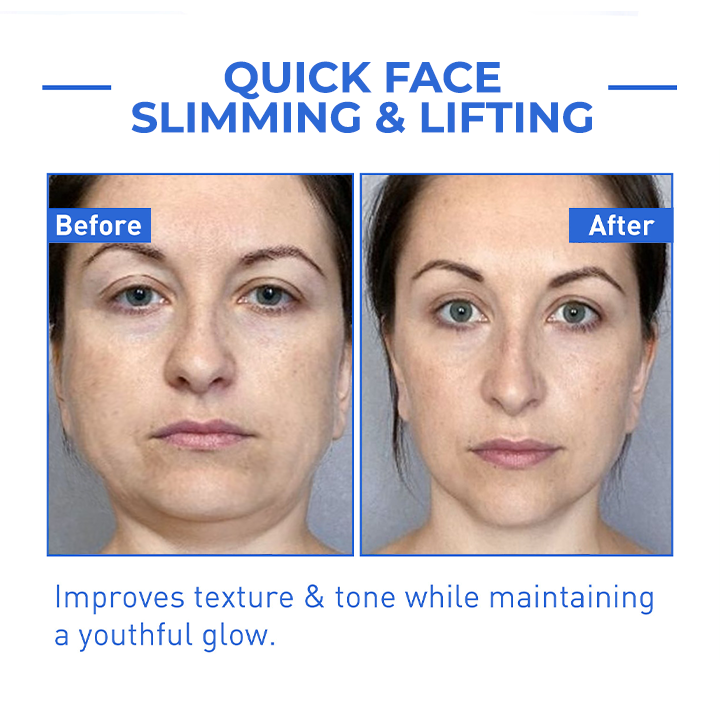 BOTOX ARCSZÉRUM | VEGYÉL 1-ET ÉS KAPSZ 1-ET INGYEN